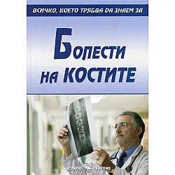 Болести по костите
