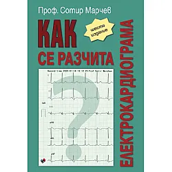 Как се разчита електрокардиограма
